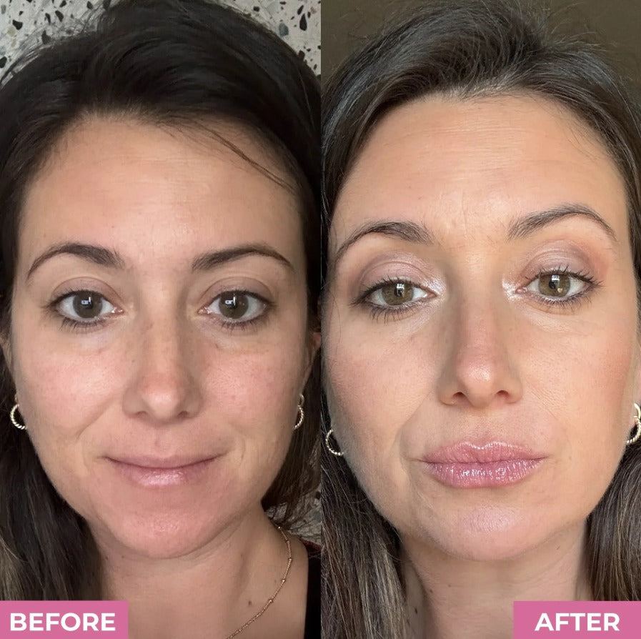 Kiss & Glow LipBoost Kit