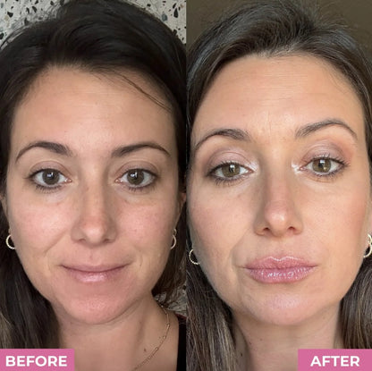 Kiss & Glow LipBoost Kit