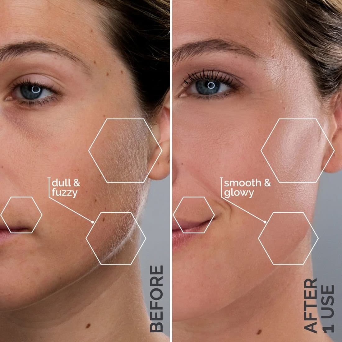 Sonic Dermaplaning Tool
